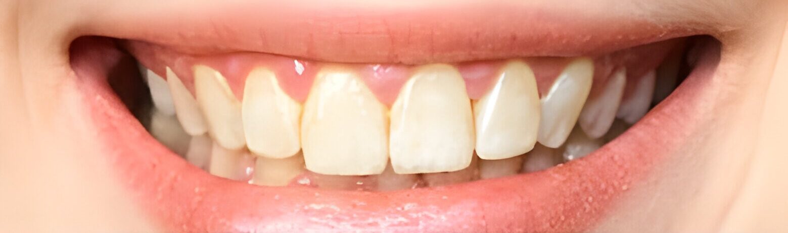 Pediatric dentist services in Delhi for children’s oral health