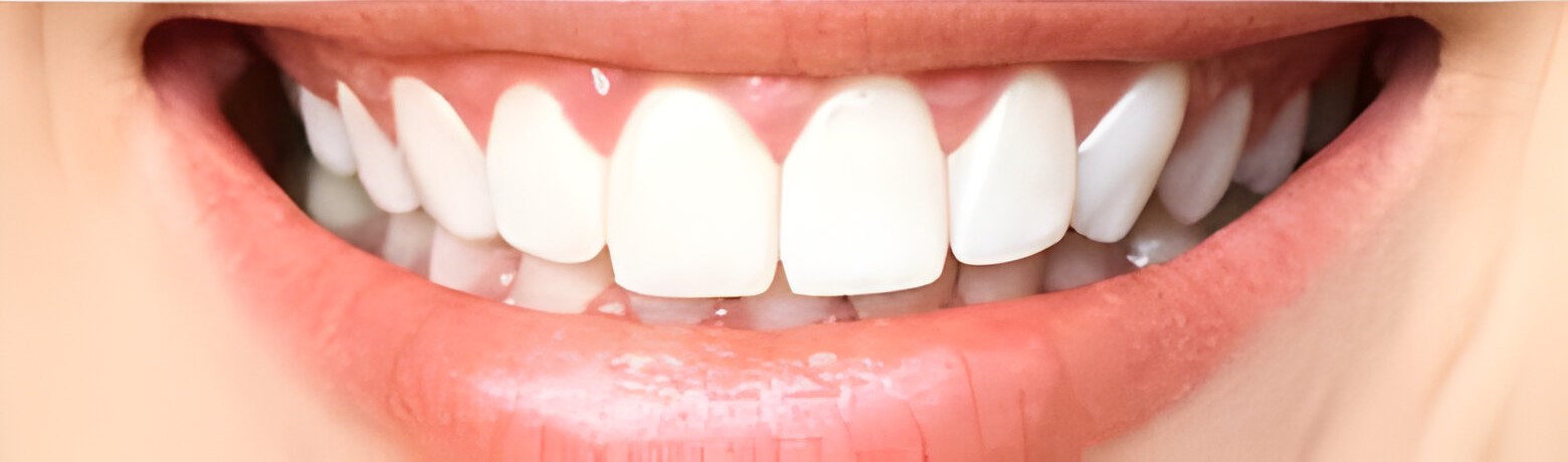 Advanced dental treatments in Delhi – implants and braces