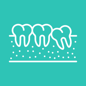 Advanced dental treatments in Delhi – implants and braces